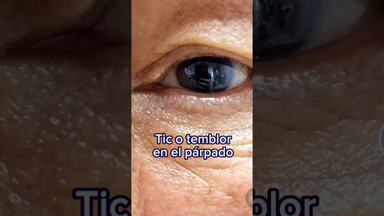 como quitar el tic nervioso del ojo