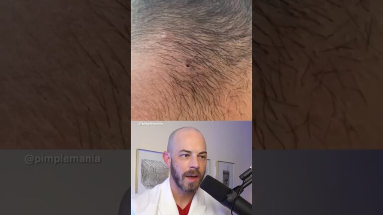 como quitar los pelos de la nuca