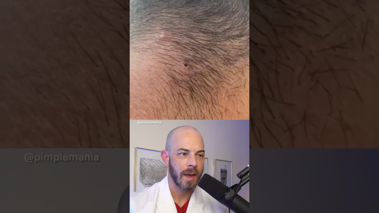 como quitar los pelos de la nuca