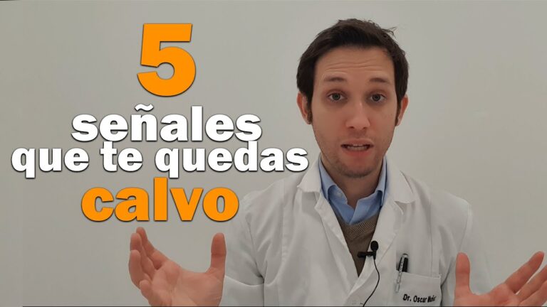 como saber si me voy a quedar calvo