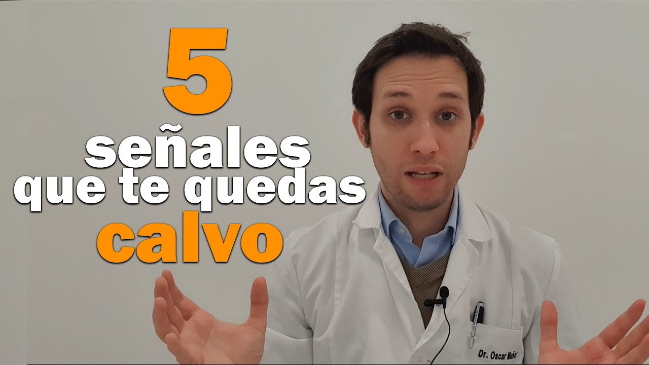 como saber si me voy a quedar calvo