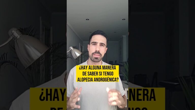 como se si voy a ser calvo