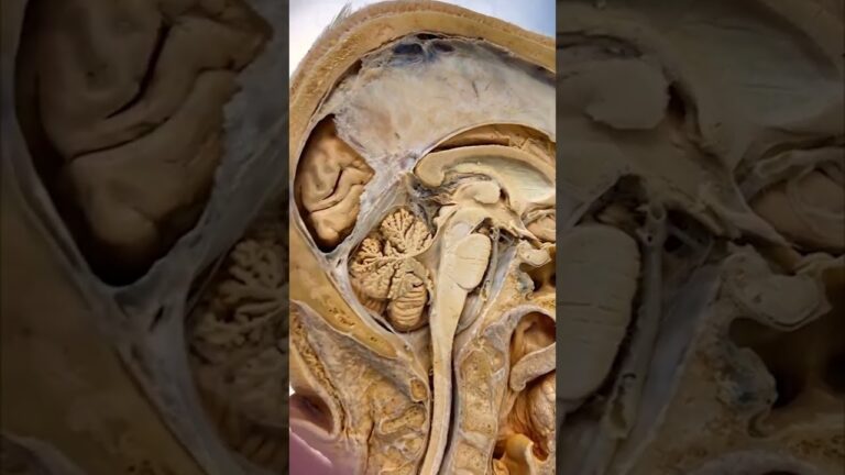 estimulacion bilateral de los hemisferios cerebrales