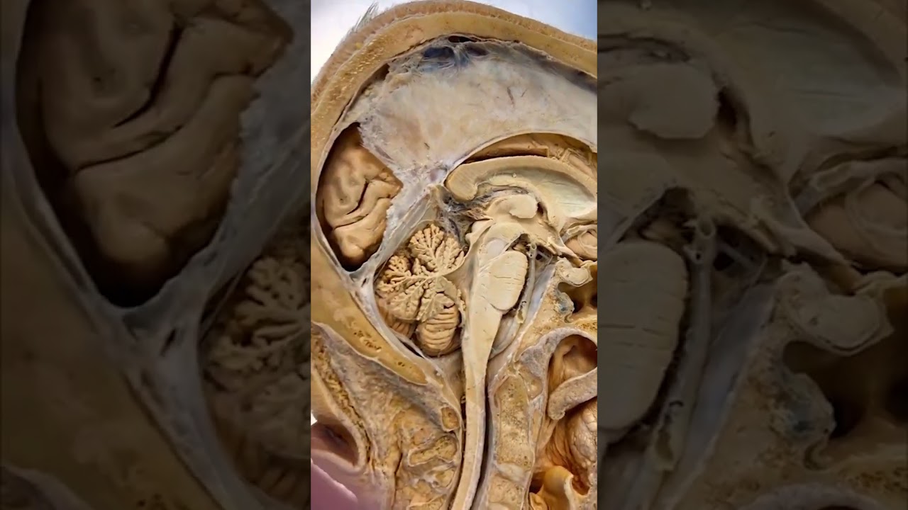 estimulacion bilateral de los hemisferios cerebrales