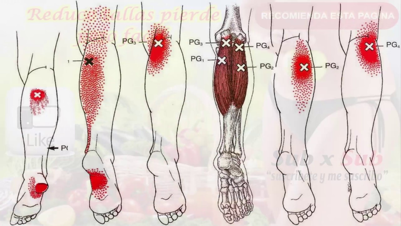fibromialgia la enfermedad de las emociones